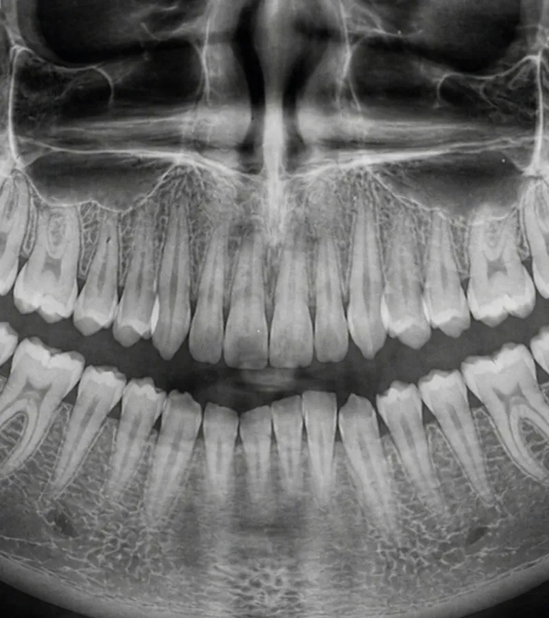 Cirugía Maxilofacial en Creu Blava
